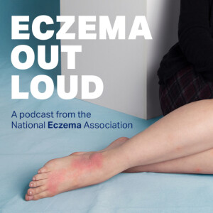 Eczema Out Loud