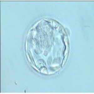 Fecundación in Vitro (FIV)