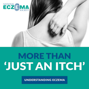 More Than "Just An Itch": Understanding Eczema
