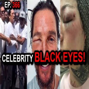 Ep. 366 - Matthew McConaughey, Bad Bhabie & Danny Trejo: Examining Celebrity Swollen Eye Incidents.