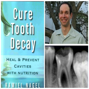 Author of Healing our Children and Cure Tooth Decay, prolific researcher and dental advocate Ramiel Nagel.