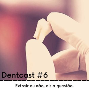 Dentcast #6 - Extrair ou não, eis a questão.