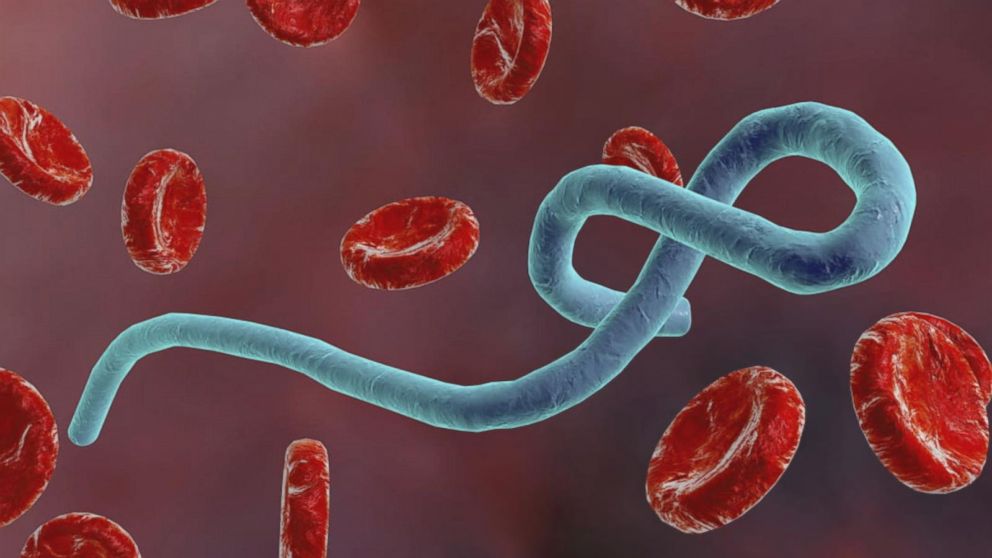 The next wave More than 60 travelers being monitored for Ebola in three states
