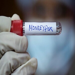 Monkey Pox is BACK with a new Name!