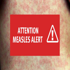 Measles alert!
