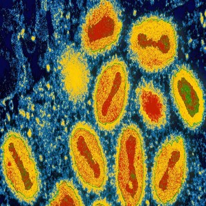 There is a NEW Deadly Virus on the way!