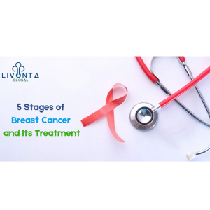 5 Stages of Breast Cancer and Its Treatment