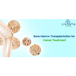 Bone Marrow Transplantation for Cancer Treatment