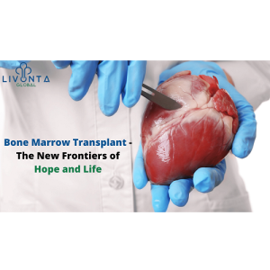 Bone Marrow Transplant – The New Frontiers of Hope and Life