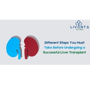 Different Steps You Must Take Before Undergoing a Successful Liver Transplant