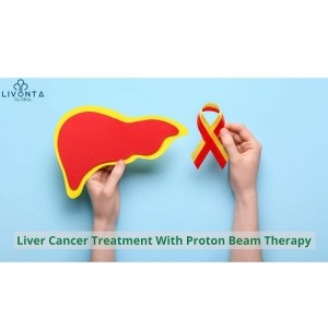 Liver Cancer Treatment With Proton Beam Therapy