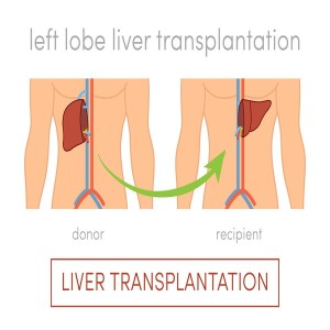 Best Liver Transplant in India