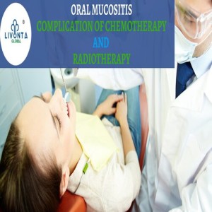 Oral mucositis: complication of chemotherapy and radiotherapy