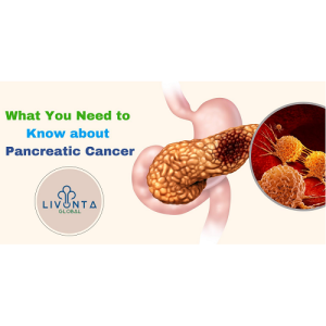 What You Need to Know about Pancreatic Cancer?