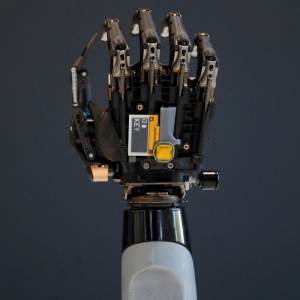 Bionic Hand Can Be Updated With New Gestures, Anytime, Anywhere