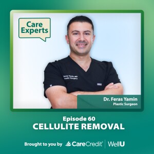 Cellulite Removal - Dr. Feras Yamin