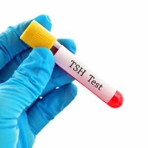 Screening for thyroid dysfunction in asymptomatic adults