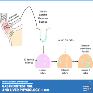 Got Guts: Plasticity of Human Barrett’s Organoids