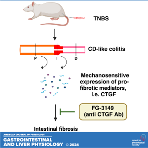 "Got Guts" The Micro Version: 	Mechanical Stress-induced Connective Tissue Growth Factor  and Intestinal Fibrosis