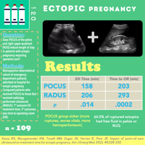 Ectopic Pregnancy