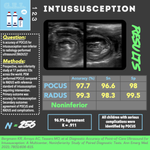 Intussusception