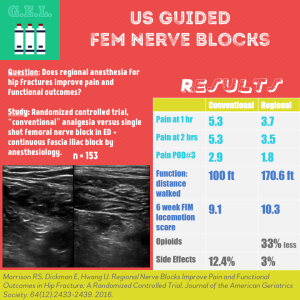 Ultrasound Guided Femoral Nerve Blocks for Hip Fractures