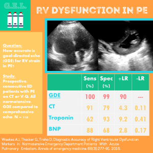 Echo for Right Ventricular Dysfunction in PE