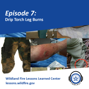 Episode 7 - Drip Torch Leg Burns