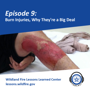 Episode 9 - Burn Injuries, Why They’re a Big Deal