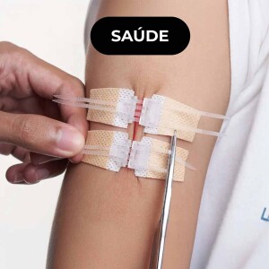 🩹 ZipClose ajuda a tratar ferimentos de forma não invasiva