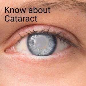 Know about Cataract