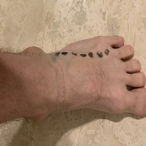 I rolled my ankle and foot hurts here. What is it?