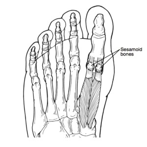 Sesamoid stress reaction healing time