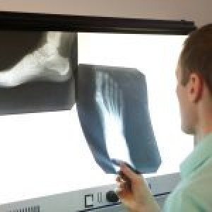 Myths About X-rays And Running Injuries