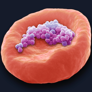 Şişelenmiş Suda Yüz Binlerce Nanoplastik