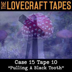 Case 15 Tape 10: Pulling A Black Tooth
