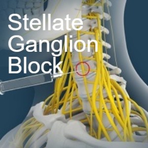 💉Stellate Ganglion Block for Trauma and PTSD - Interview with Dr. James Lynch
