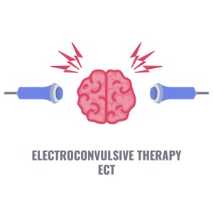 Electric Insights: Understanding Electroconvulsive Therapy (ECT) | Mind Matters | University Behavioral