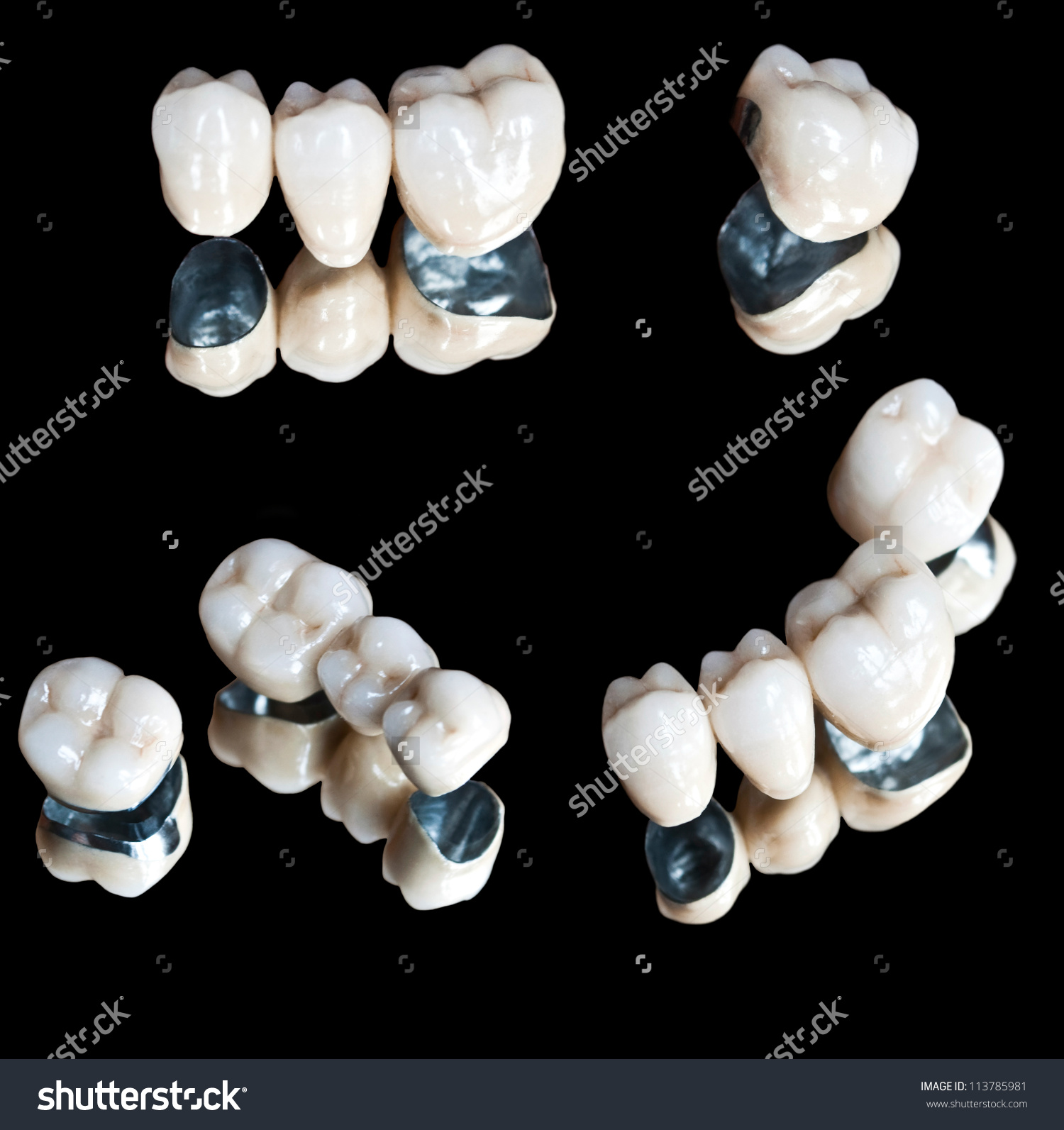 clínica dental las palmas
