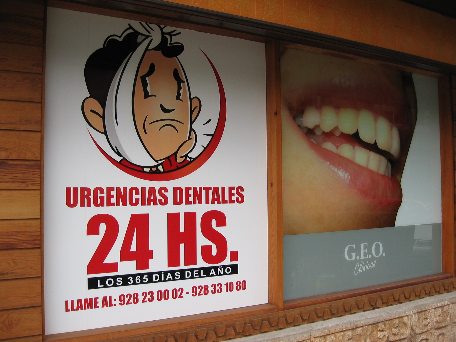 implantes dentales en las palmas