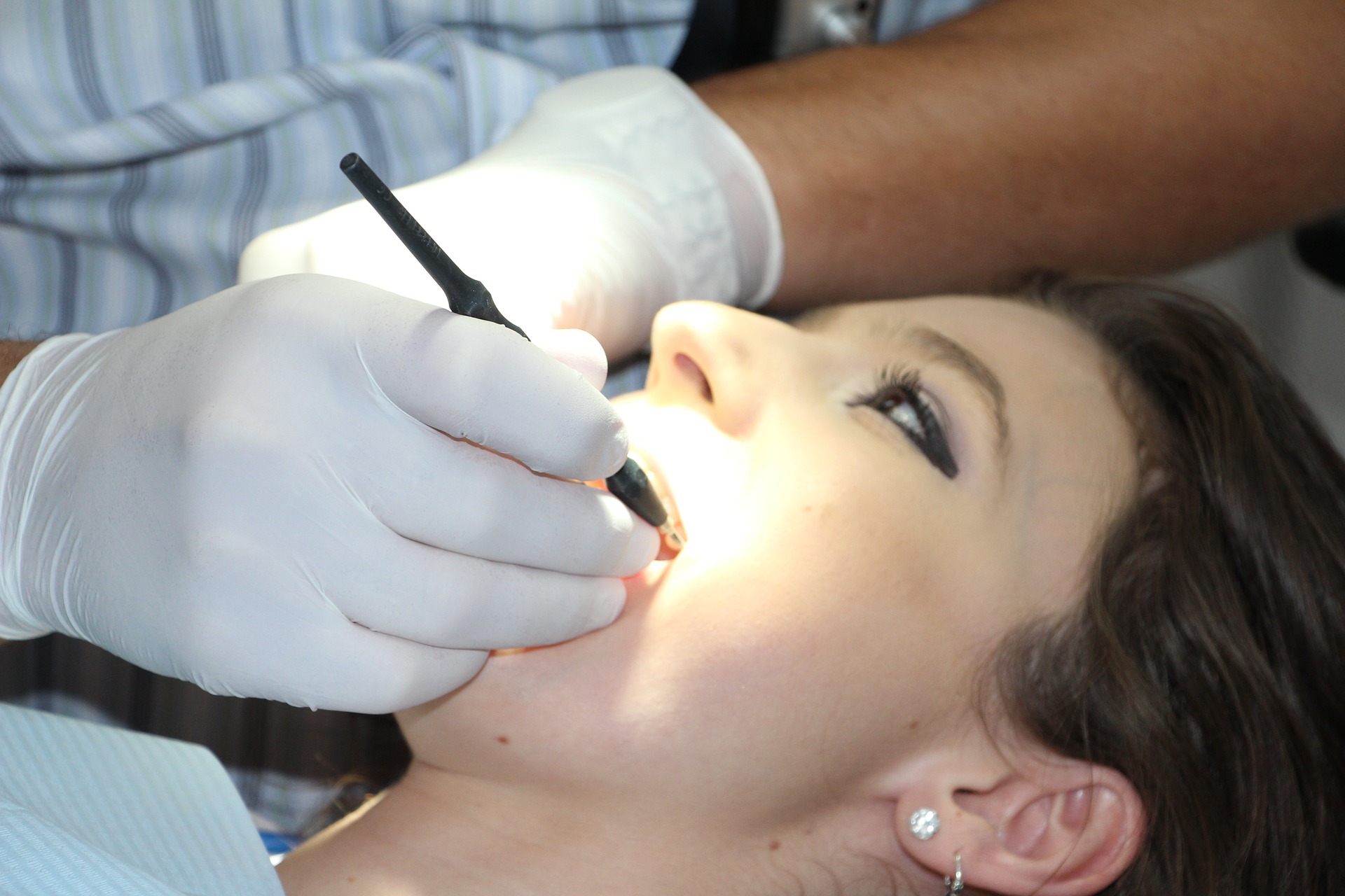 Sedation Dentistry Lakewood California