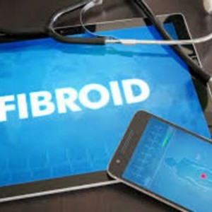 Fibroid Natural Healing Program
