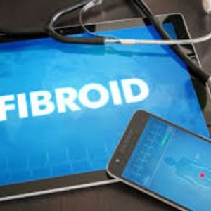 Fibroid Natural Healing Program