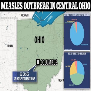 Ohio Measles Outbreak?! #102