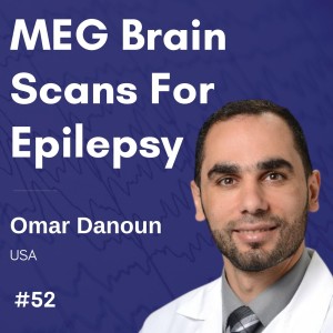 MEG Brain Scans For Epilepsy - Omar Danoun