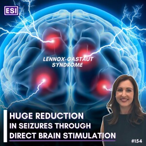 Huge Seizure Reduction Through DBS (in LGS) - Linda Dalic