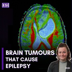 Epilepsy Caused by Brain Tumours - Kate Connor