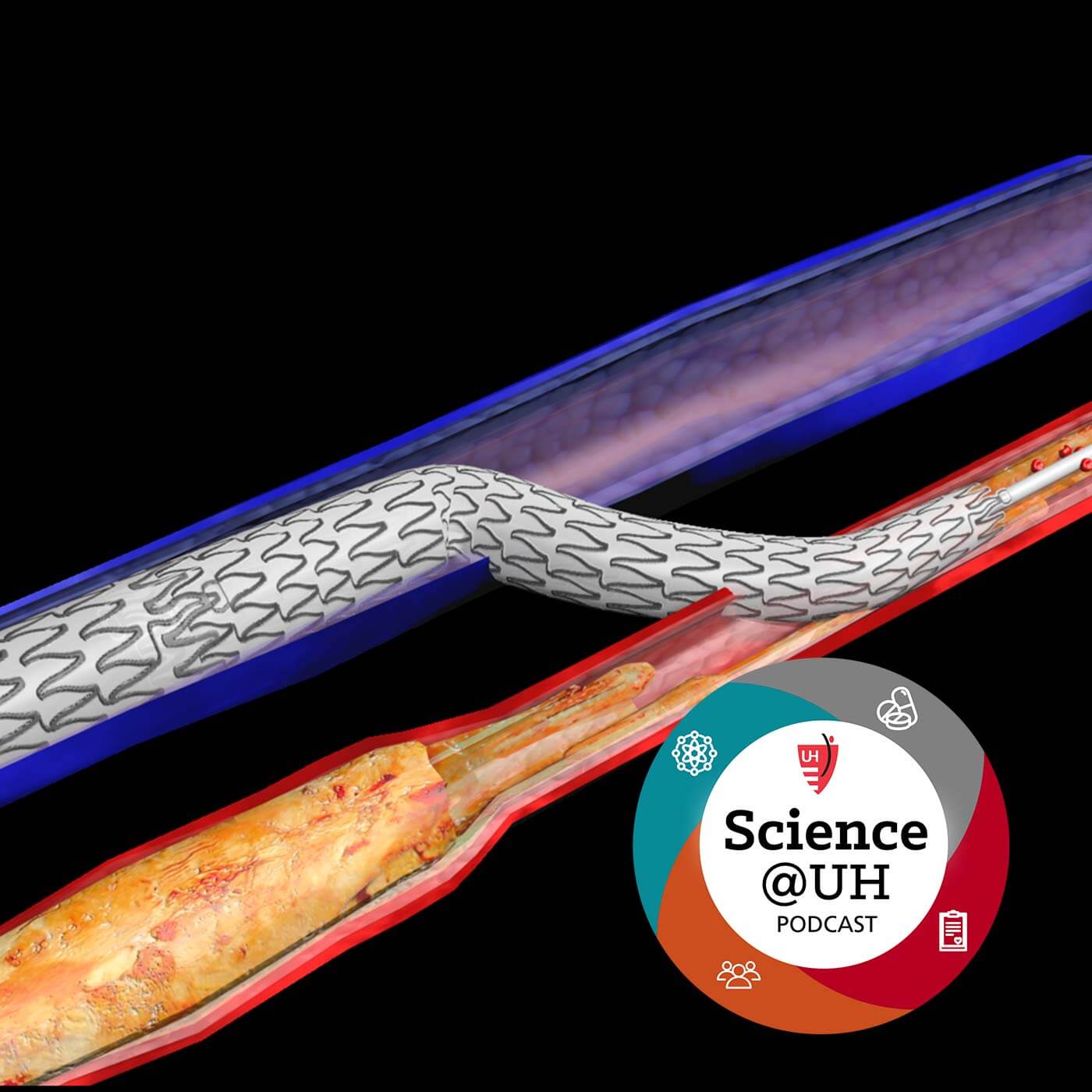 LimFlow Technology Redefines Biology: Reverses Blood Flow to Prevent Limb Amputations