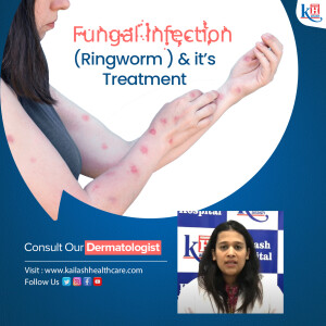 Fungal Infection (Ringworm ) and it’s Treatment | Best Dermatologist in Noida