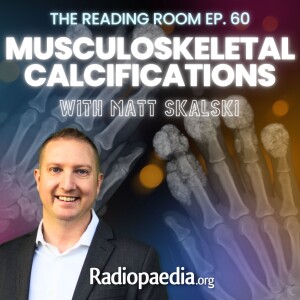 60. Musculoskeletal calcifications with Matt Skalski